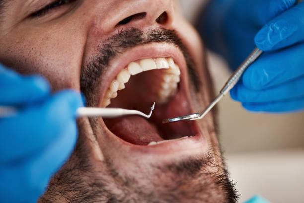 Best Emergency Treatment for Dental Infections or Abscesses in Lumberton, TX